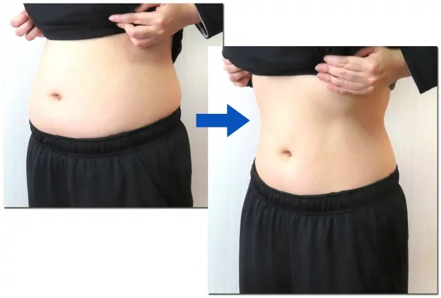 肥満遺伝子検査をきっかけに成功したダイエット体験談と実例